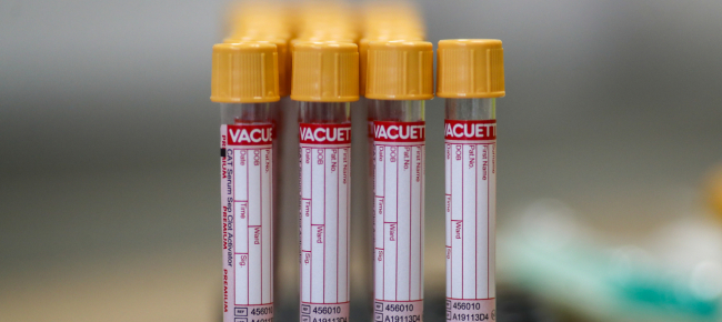 coronavirus-isolati-i-super-anticorpi-svolta-nelle-cure
