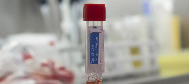 coronavirus-il-ticino-alza-il-grado-d-allerta