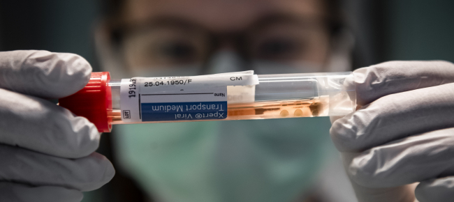 coronavirus-108-contagi-in-svizzera-nelle-ultime-24-ore
