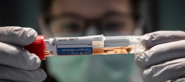 coronavirus-in-svizzera-187-nuovi-casi-nelle-ultime-24-ore