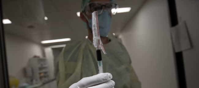 coronavirus-in-svizzera-161-nuovi-casi-e-3-decessi