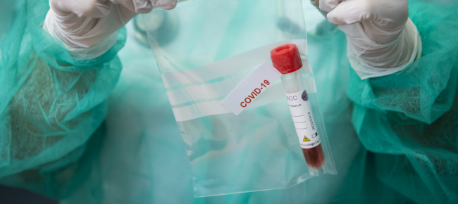 coronavirus-in-svizzera-372-nuovi-contagi