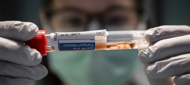 coronavirus-in-svizzera-3-105-nuovi-casi-e-cinque-morti