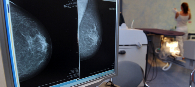 bellinzona-si-combatte-il-cancro-al-seno-a-colpi-di-pedale