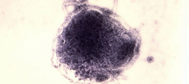 si-muore-di-morbillo-due-volte-di-piu
