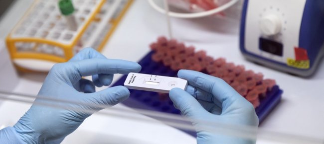 coronavirus-primo-caso-di-mutazione-nel-canton-neuchatel