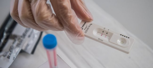 i-grigioni-puntano-sui-test-di-massa