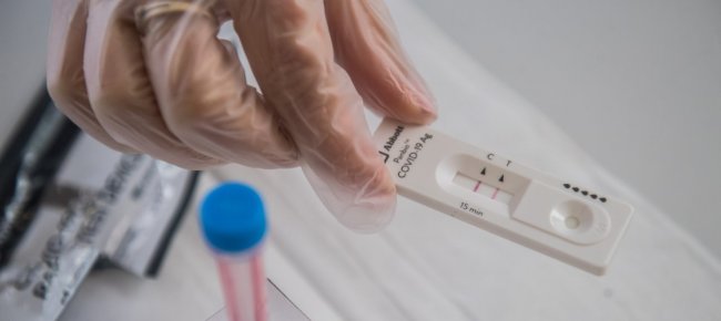 coronavirus-calo-casi-nel-mondo-per-sesta-settimana-consecutiva