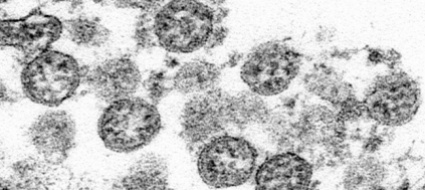 coronavirus-in-belgio-un-test-rapido-e-a-buon-mercato