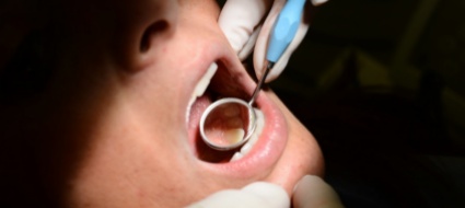 decreto-d-accusa-per-il-finto-dentista-senza-diploma