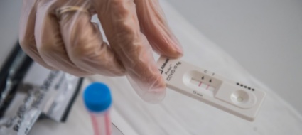 test-covid-gratuiti-cresce-la-pressione-sul-consiglio-federale