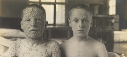 gli-antivaccinisti-al-tempo-del-vaiolo-correva-l-anno-1931