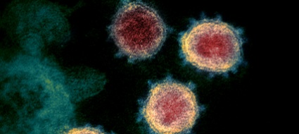 dai-cambiamenti-climatici-15mila-virus-mai-visti-entro-il-2070