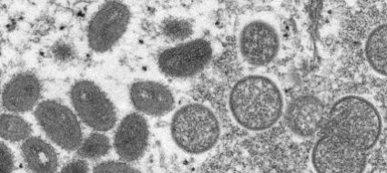 il-vaiolo-delle-scimmie-si-puo-contenere