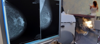 cancro-al-seno-nuova-frontiera-per-cellule-meno-dannose