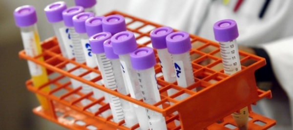 l-incubo-superbatteri-apre-scenari-da-medioevo-della-sanita