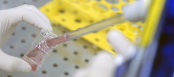 coronavirus-merlani-probabilita-bassa-di-un-caso-in-ticino