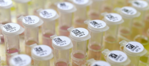 coronavirus-dagli-usa-lotto-di-vaccino-per-la-fase-sperimentale