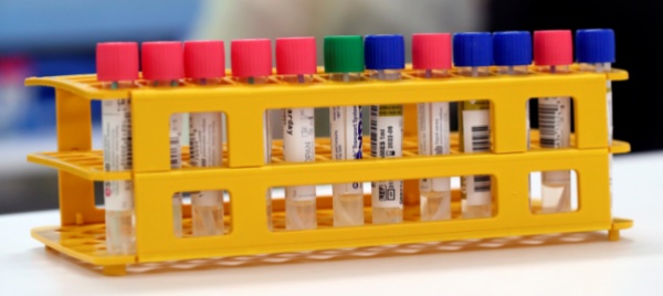 londra-nessuna-prova-che-il-covid-sia-uscito-da-un-laboratorio