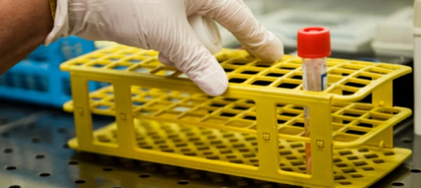 coronavirus-esperti-puntano-su-anticorpi-di-precisione