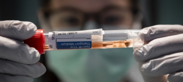 coronavirus-in-svizzera-58-nuovi-casi-nelle-ultime-24-ore