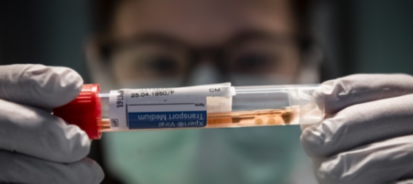 coronavirus-37-nuovi-casi-in-svizzera-nelle-ultime-24-ore