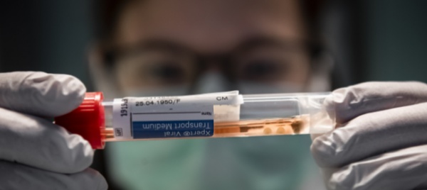 coronavirus-in-svizzera-132-nuovi-casi-nelle-ultime-24-ore