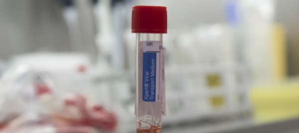 coronavirus-il-ticino-alza-il-grado-d-allerta