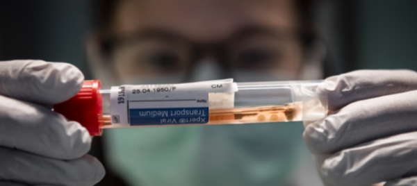 coronavirus-in-svizzera-187-nuovi-casi-nelle-ultime-24-ore
