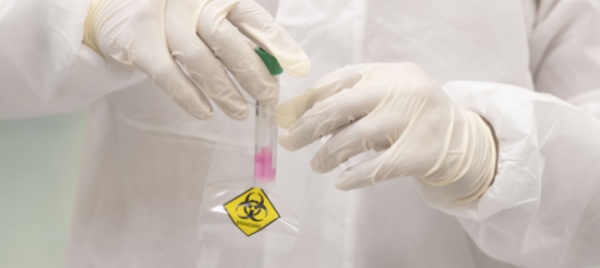 coronavirus-12-casi-nel-weekend-in-ticino