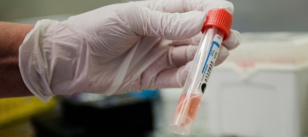 coronavirus-in-svizzera-128-nuovi-contagi-ma-anche-pochi-test