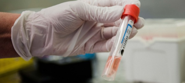 coronavirus-tre-casi-in-ticino-nessun-decesso