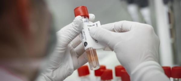 coronavirus-in-svizzera-411-nuovi-casi-e-un-decesso