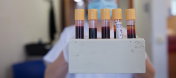 coronavirus-in-ticino-3-nuovi-casi-nelle-ultime-24-ore