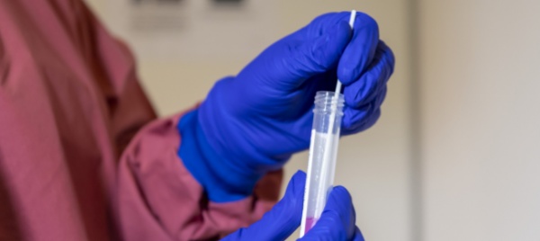 coronavirus-in-svizzera-1-077-nuovi-contagi-in-24-ore