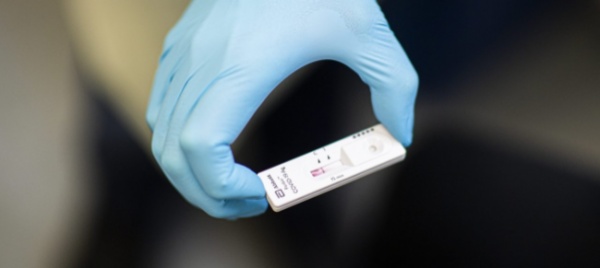 coronavirus-2-411-casi-di-mutazione-in-svizzera