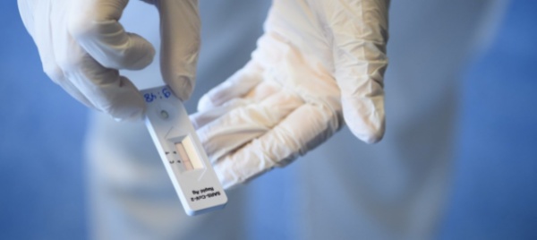 coronavirus-ancora-in-calo-casi-settimanali-bene-il-ticino