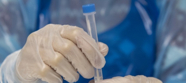 roche-lancia-un-nuovo-test-rapido