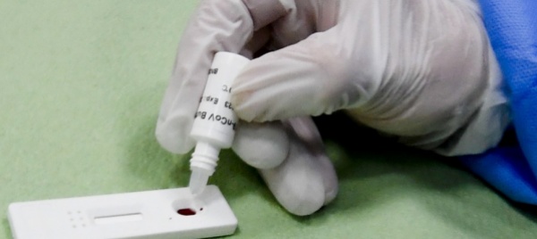 dalla-svizzera-un-test-del-sangue-per-l-immunita-alle-varianti