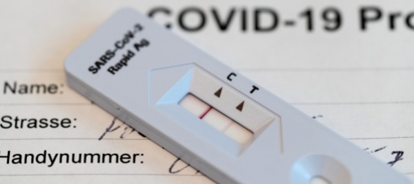 in-svizzera-853-nuovi-contagi-piu-pazienti-covid-in-cure-intense