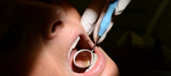 formazione-igienista-dentale-sss-pure-in-ticino-l-idea-piace