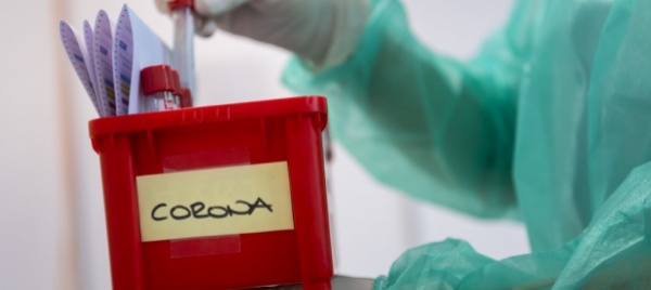 in-svizzera-158-nuovi-contagi-2-decessi