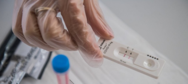 861-nuovi-contagi-in-svizzera-situazione-ospedaliera-stabile