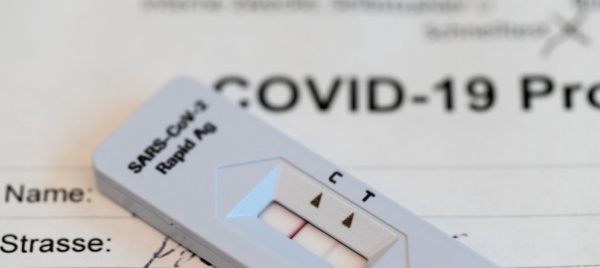 in-svizzera-1-910-nuovi-contagi-piu-ricoveri-in-cure-intense