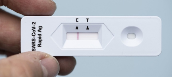 il-prezzo-del-test-covid-potrebbe-salire-a-75-franchi