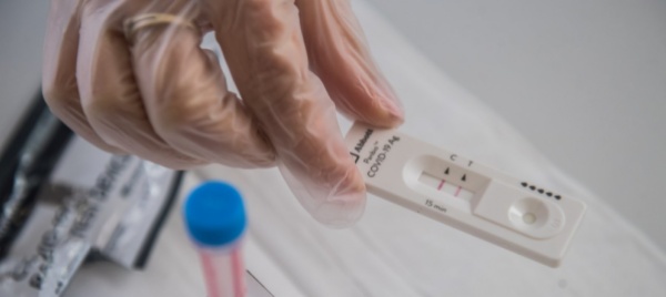 test-covid-gratuiti-cresce-la-pressione-sul-consiglio-federale