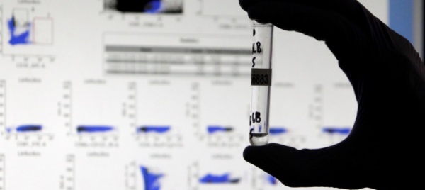 prosegue-lo-studio-sull-immunita-al-coronavirus-in-ticino