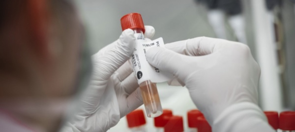 coronavirus-7-persone-in-piu-in-ospedale-nelle-ultime-24-ore