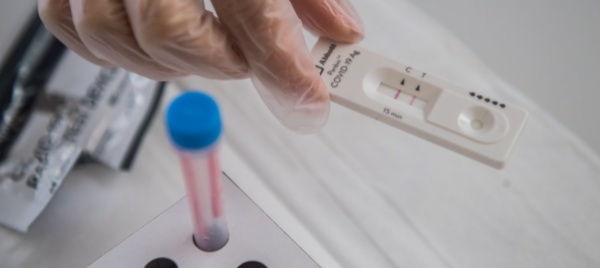 coronavirus-ospedalizzazioni-in-leggero-aumento-in-ticino