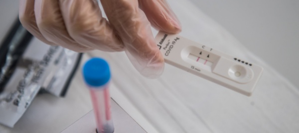 il-consiglio-federale-vuole-i-test-covid-gratuiti-fino-al-2024